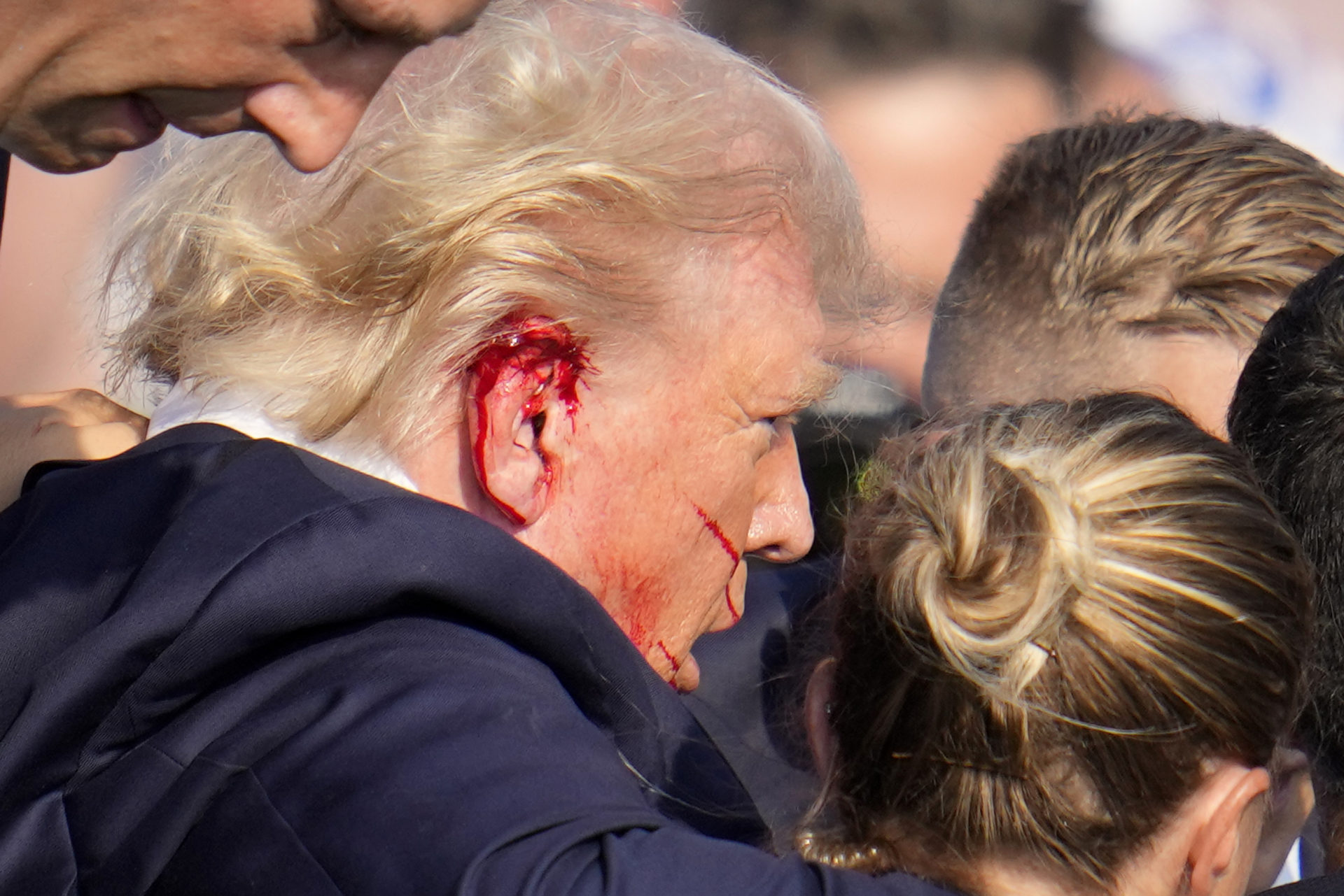FBI Confirms Trump Was Struck By Bullet During Assassination Attempt